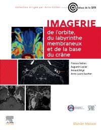 Imagerie de l'orbite, du labyrinthe membraneux et de la base du crâne