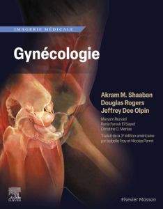 Imagerie médicale : Gynécologie