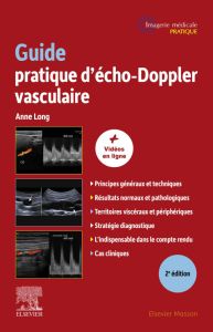 Guide pratique d'écho-Doppler vasculaire