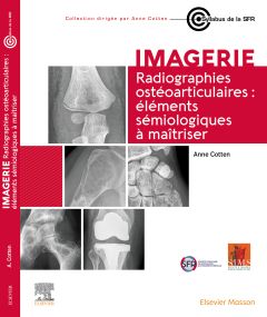 Radiographies ostéoarticulaires : éléments sémiologiques à maitriser