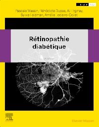 Rétinopathie diabétique