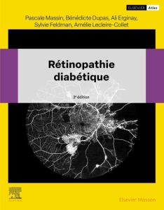 Rétinopathie diabétique