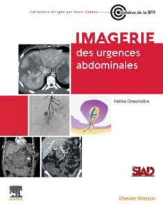 Imagerie des urgences abdominales