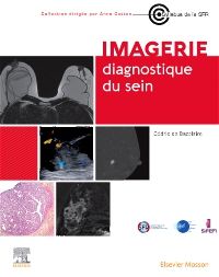 Imagerie diagnostique du sein
