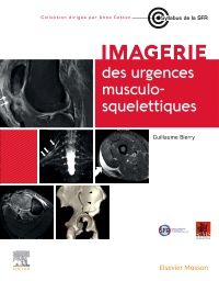 Imagerie des urgences musculosquelettiques