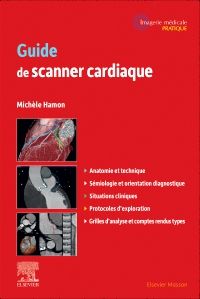 Guide de scanner cardiaque