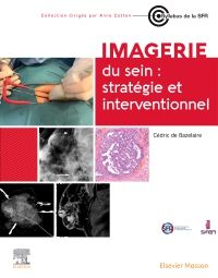 Imagerie du sein : stratégie et interventionnel