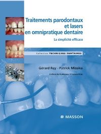 Traitements parodontaux et lasers en omnipratique dentaire