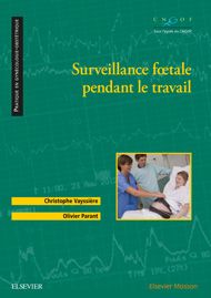 Surveillance fœtale pendant le travail