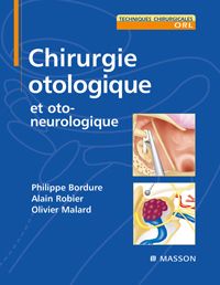 Chirurgie otologique