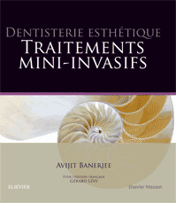 Dentisterie esthétique : traitements mini-invasifs