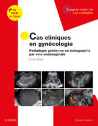 Cas cliniques en imagerie : gynécologie