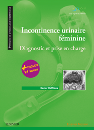 Incontinence urinaire féminine