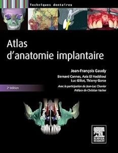 Atlas d'anatomie implantaire