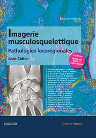 Imagerie musculosquelettique : pathologies locorégionales