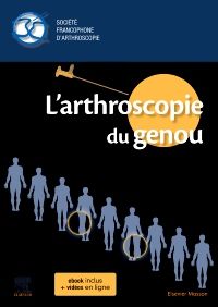 L'arthroscopie du genou 1e Chirurgie orthopédique/Traumatologie Livre (SFA) Société Francophone d'Arthroscopie, Christel Conso