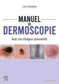 Manuel de dermoscopie 1e Dermatologie/Vénérologie Livre Luc THOMAS