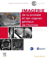 Imagerie de la prostate et des organes génitaux de l?homme 1e Imagerie médicale Livre Laurence Rocher, Raphaëlle Renard-Penna