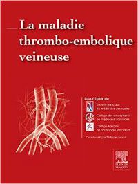 La maladie thrombo-embolique veineuse 1e Cardiologie/Médecine vasculaire Livre (SFMV) Société Française de Médecine Vasculaire, (CEMV) Collège des enseignants de médecine vasc, (CFPV) Collège Français de Pathologie Vasculaire, Philippe Lacroix