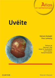 Uvéite 2e Ophtalmologie Livre Bahram Bodaghi, Phuc LeHoang