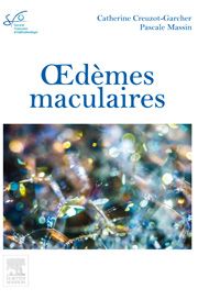 Oedèmes maculaires 1e Ophtalmologie Livre Catherine Creuzot-Garcher, Pascale Massin