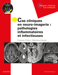 Cas cliniques en neuro-imagerie : pathologies inflammatoires et infectieuses 1e Imagerie médicale Livre François Cotton, Stéphane Kremer