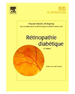 Rétinopathie diabétique