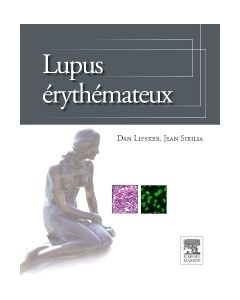 Lupus érythémateux