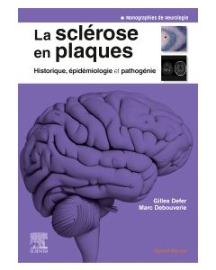 La sclérose en plaques - Historique, épidémiologie et pathogénie