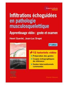 Infiltrations échoguidées en pathologie musculosquelettique