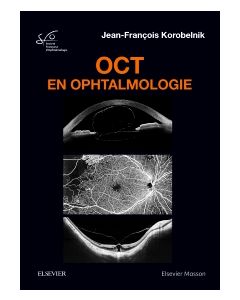 OCT en ophtalmologie