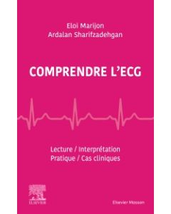 Comprendre l'ECG