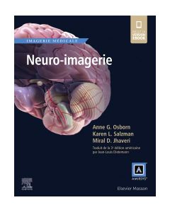 Neuro-imagerie
