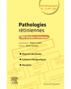 Pathologies rétiniennes : 100 études cliniques