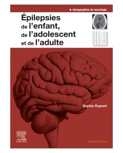 Epilepsies de l'enfant, de l'adolescent et de l'adulte