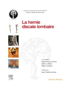 La hernie discale lombaire