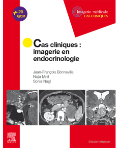 Cas cliniques en imagerie : endocrinologie