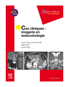 Cas cliniques en imagerie : endocrinologie