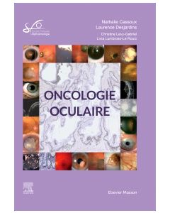 Oncologie oculaire