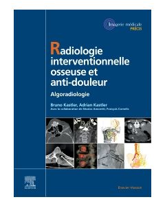 Radiologie Interventionnelle osseuse et anti-douleur