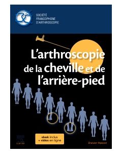 L'arthroscopie de la cheville et de l'arrière-pied