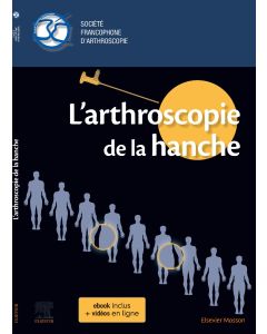 L'arthroscopie de la hanche