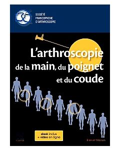 L'arthroscopie de la main, du poignet et du coude