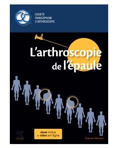 L'arthroscopie de l'épaule