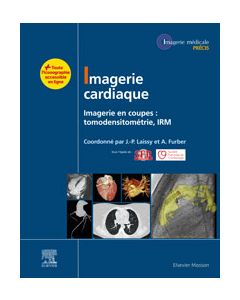 Imagerie cardiaque