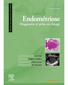 Endométriose