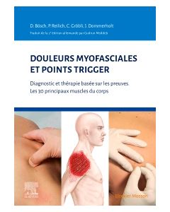 Douleurs myofasciales et points trigger