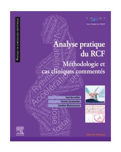 Analyse pratique du RCF : rythme cardiaque foetal