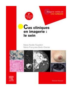 Cas cliniques en imagerie : le sein