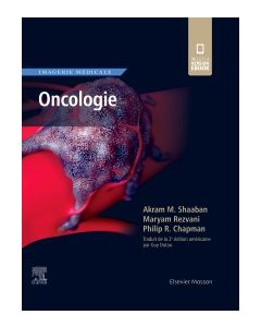 Imagerie médicale : Oncologie